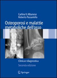 Osteoporosi e malattie metaboliche dell'osso