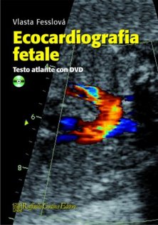 Ecocardiografia fetale - Testo atlante con DVD