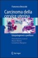 Carcinoma della cervice uterina - Eziopatogenesi e profilassi